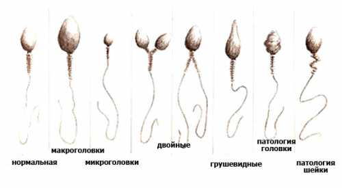 Морфология сперматозоидов